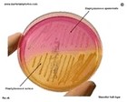 Staphylococcus on mannitol salt agar